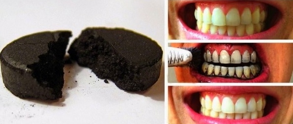 sbiancare-denti-carbone
